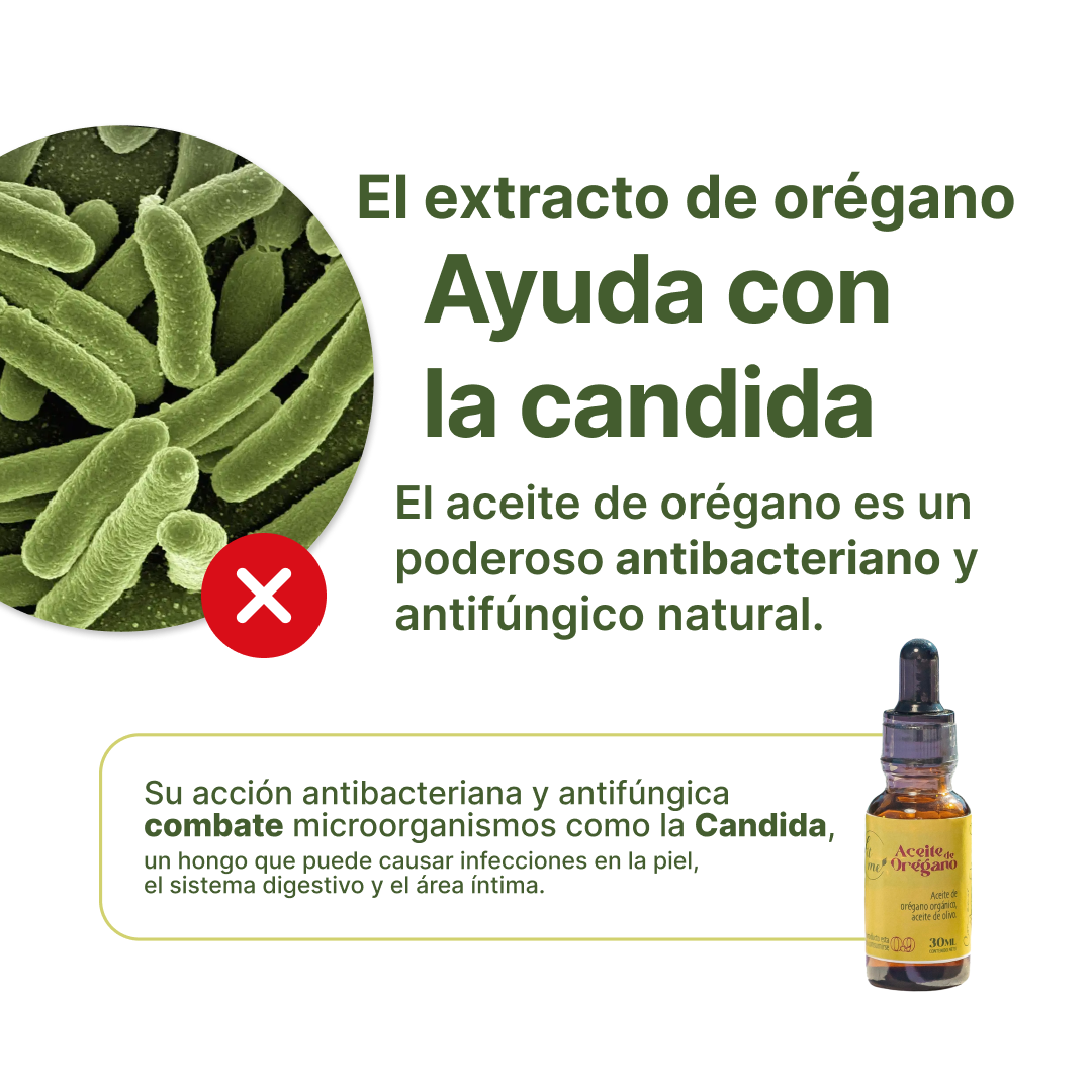 Aceite de oregano